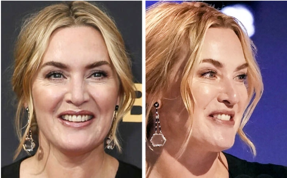 7. Kate Winslet