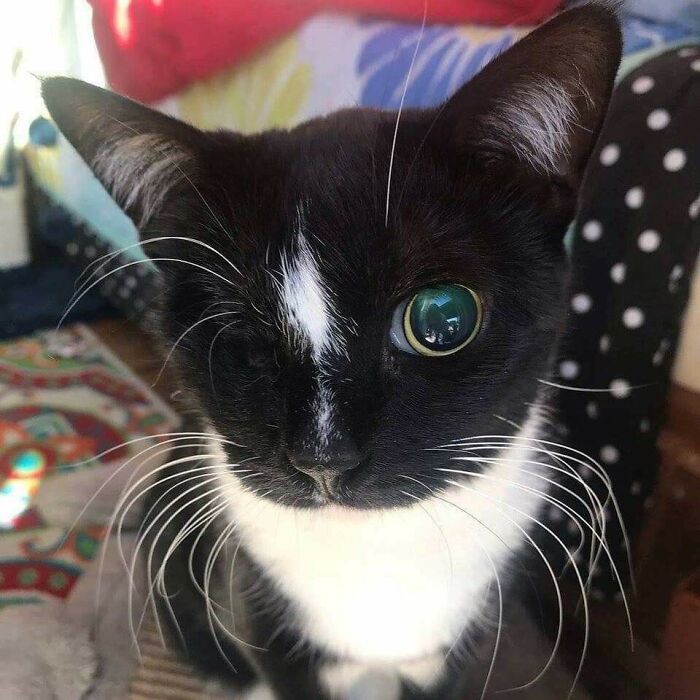 2. "I'm hoping one eye will suffice."