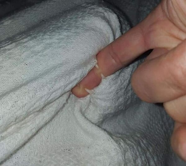 "What is biting through that blanket?"