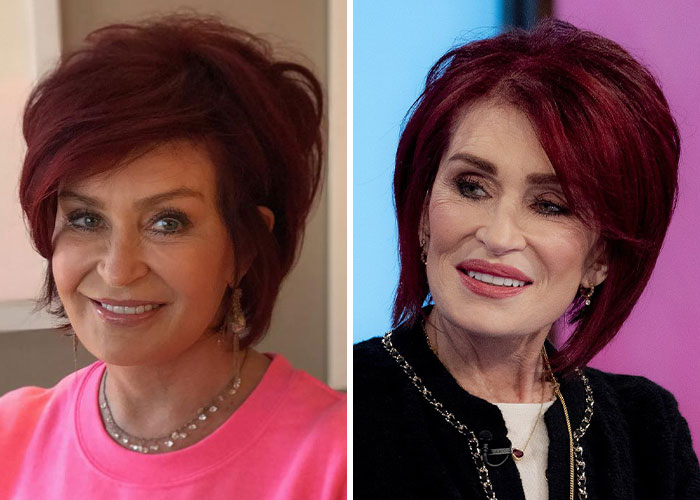 One celebrity with one of the most striking instances of an Ozempic face, according to experts, is Sharon Osbourne