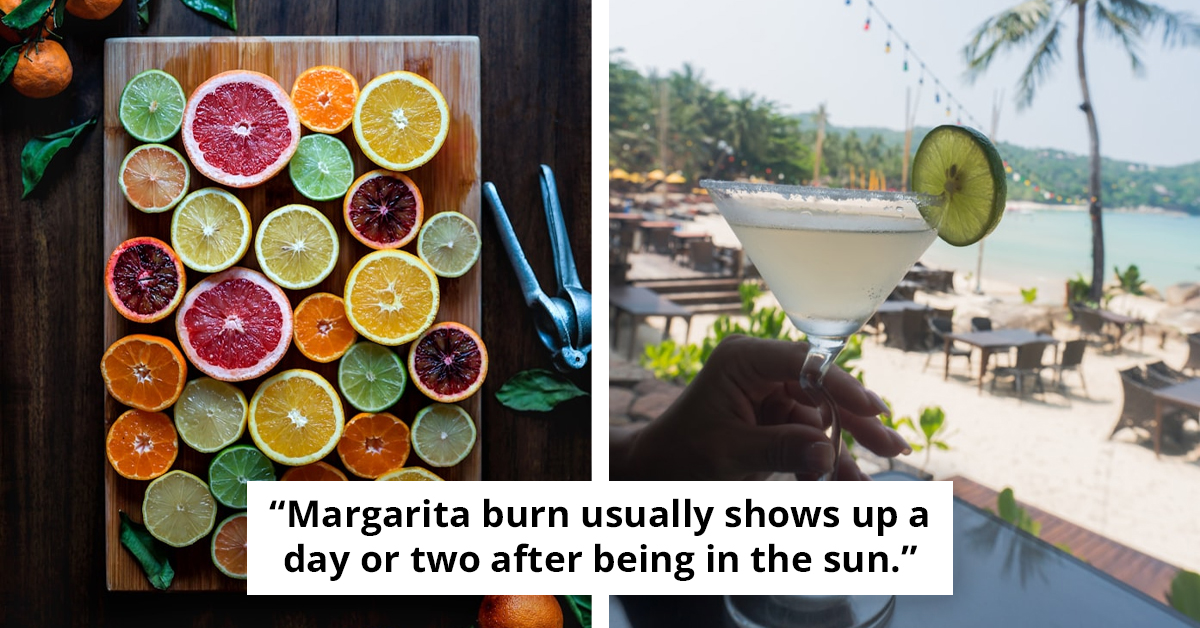 Summer Citrus Drinks Could Leave You With Painful 'Margarita Burn'
