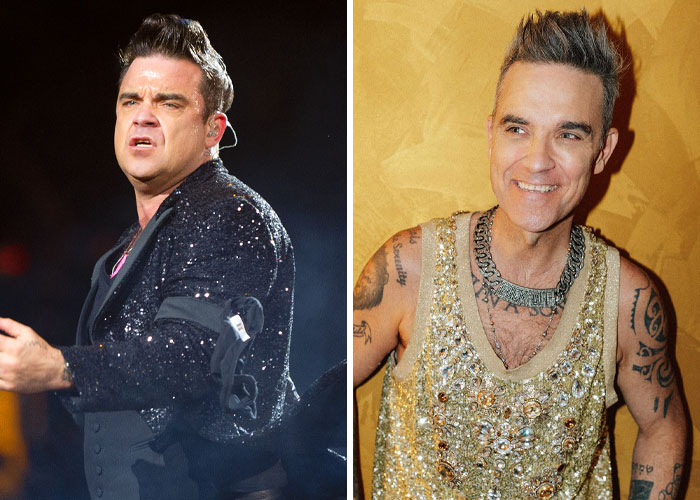 According to reports, the doctor also included Robbie Williams as one of the superstars having some of the most well-known Ozempic faces