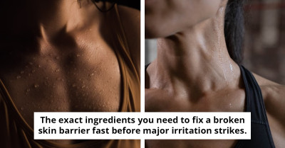 'Swoobies' Could Be More Than an Annoyance as Doctor Explains Heatwave Skin Risk