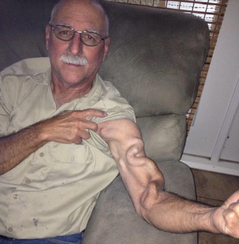 18. "Here's a snapshot of a family friend before his surgery..."